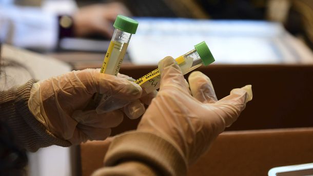 Rusia confirma que el primer lote de la vacuna contra el coronavirus será producido en 2 semanas
