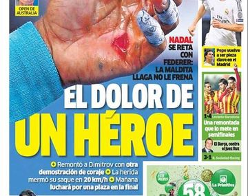 En Europa afirman que Falcao se perderá el Mundial