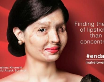 Desfigurada y modelo en NY