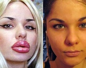 Antes-y-despúes