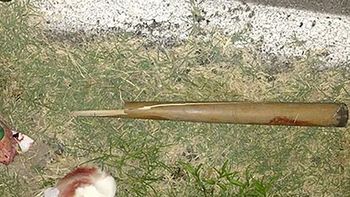 un joven dejo con muerte cerebral a su tio tras golpearlo con un bate de beisbol un joven dejo con muerte cerebral a su tio tras golpearlo con un bate de beisbol