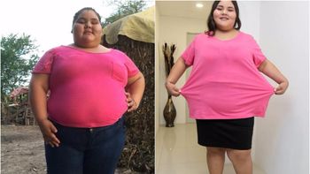 Tiene 14 años y bajó 90 kilos para celebrar sus 15 Tiene 14 años y bajó 90 kilos para celebrar sus 15