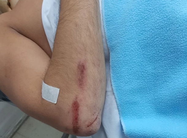 Salvaje ataque de un rugbier en un bar de Mar del Plata: Lo siguió golpeando estando desmayado