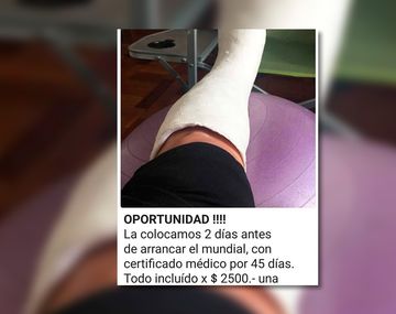 La mejor excusa para ver el Mundial desde tu casa: un yeso para faltar al trabajo