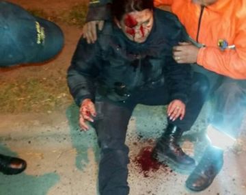 Así quedó la mujer policía atropellada