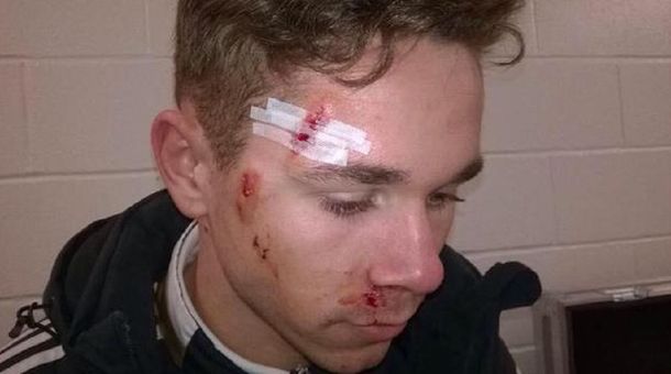 Le arruinó la cara: mirá esta brutal patada en el fútbol escocés