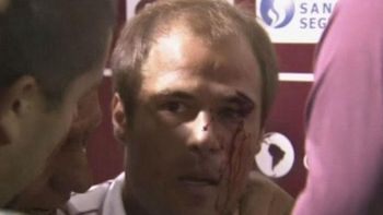 un jugador de lanus fue agredido por un hincha tras la derrota con argentinos un jugador de lanus fue agredido por un hincha tras la derrota con argentinos