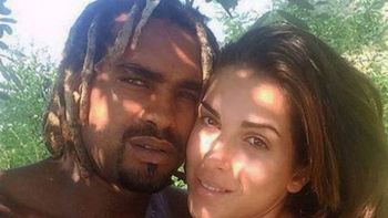 Relato de modelo italiana rociada con ácido por su ex novio Relato de modelo italiana rociada con ácido por su ex novio