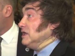 Qué le pasó a Javier Milei en el cuello: la explicación oficial Qué le pasó a Javier Milei en el cuello: la explicación oficial
