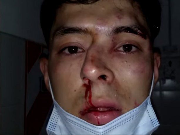 Chaco: le rompieron el tabique por defender a una amiga