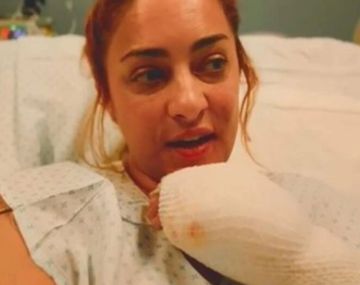 La impactante imagen de María Julia Oliván tras sufrir graves quemaduras
