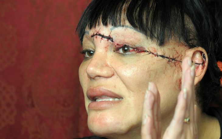 Aldana fue brutalmente atacada. Gentileza: La Nueva