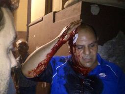 la policia volvio a la calle y reprimio a manifestantes la policia volvio a la calle y reprimio a manifestantes