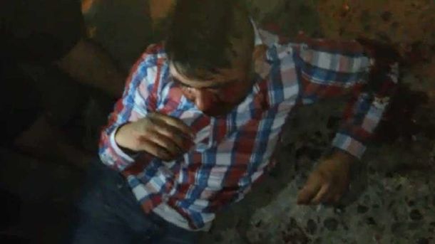 Un grupo de vecinos le  desfiguró la cara a un ladrón en Tucumán.