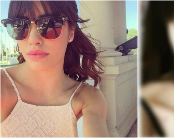 Los fans critican a Lali Espósito por su nuevo piercing