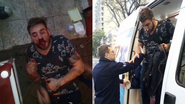 Un trapito le rompió el tabique para robarle