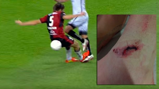 Menos mal que son compatriotas: así le dejó el tobillo Kannemann a Sambueza