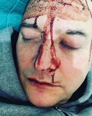 Brutal ataque homofóbico a Leo García en General Rodríguez