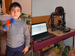 sin saber de ortopedia, construyo una protesis para su hijo sin saber de ortopedia, construyo una protesis para su hijo