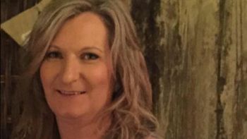 asi se ve mi cancer: compartio en facebook su enfermedad y se hizo viral asi se ve mi cancer: compartio en facebook su enfermedad y se hizo viral