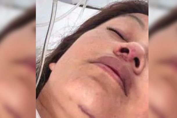 Una mujer se tiró de un segundo piso para evitar que su pareja la mate