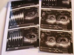 Yanina y Matías serán padres primerizos Yanina y Matías serán padres primerizos