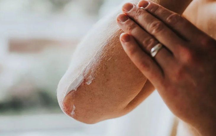 ANMAT prohibió una serie de cremas terapéuticas y productos para piletas: de cuáles se trata
