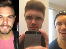 Tuvo una fuerte reacción a la tintura para pelo