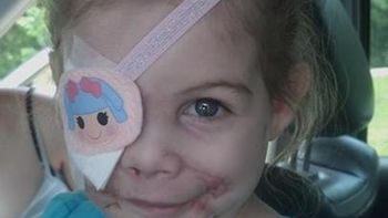 indemnizan a una nena de 3 anos por haberla echado de un restaurante por sus cicatrices indemnizan a una nena de 3 anos por haberla echado de un restaurante por sus cicatrices