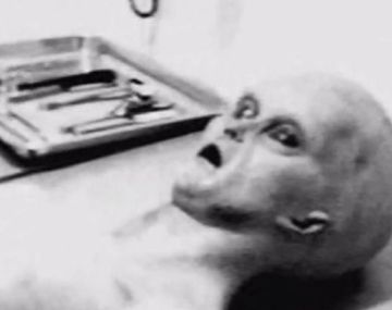Prueba indicaría que la autopsia a un alien fue real