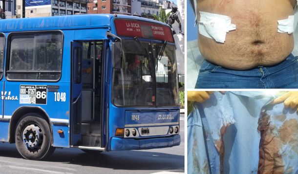Apuñalaron a un colectivero para robarle en González Catán