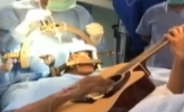 Tocó la guitarra mientra lo operaban en el cerebro