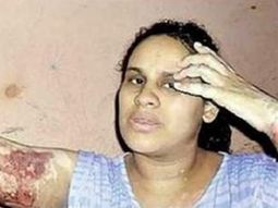 ex director del inadi acusado por prender fuego a su pareja quedo libre y le volvio a pegar
