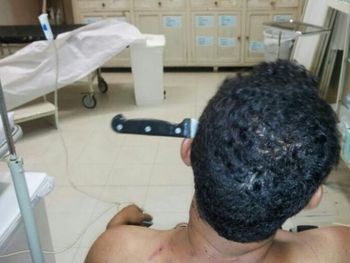Médicos le retiran a un hombre un cuchillo que tenía clavado en la cabeza