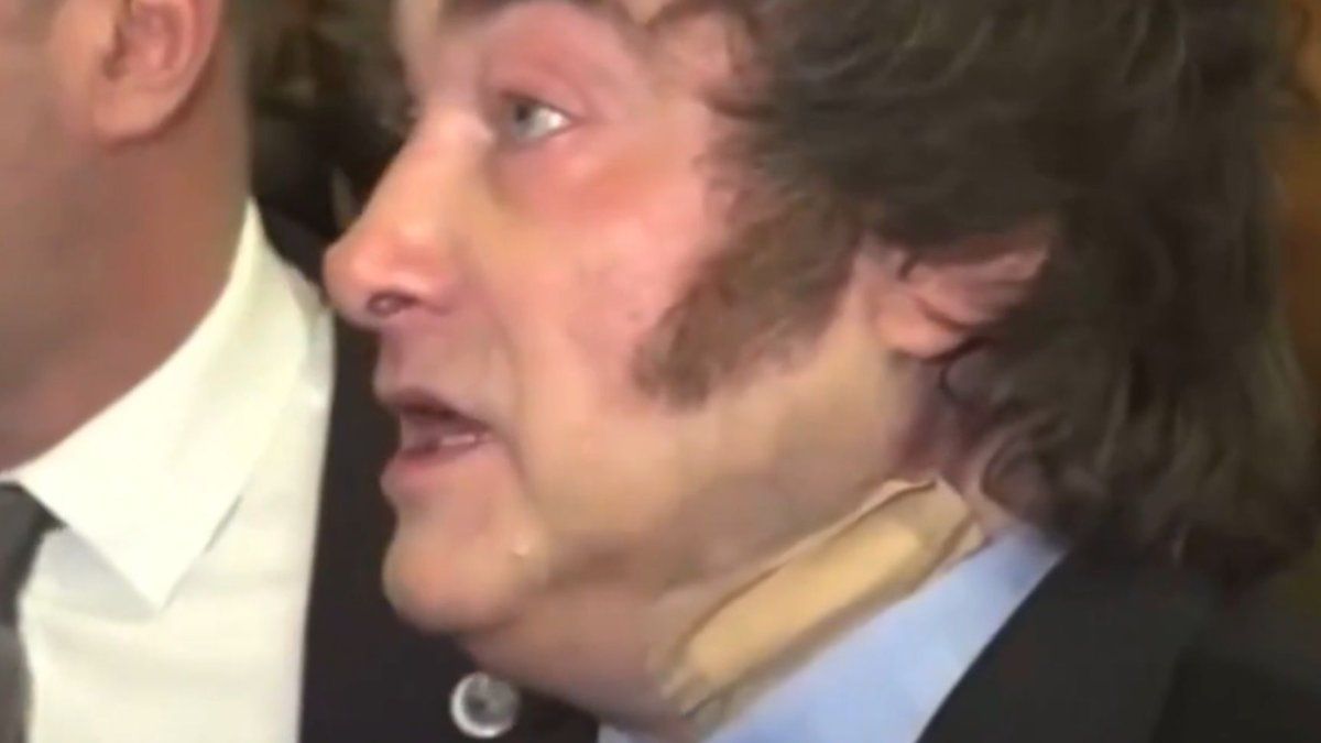 Qué le pasó a Javier Milei en el cuello: la explicación oficial
