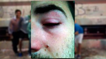 se recibio de arquitecto, pero el festejo de sus amigos arruino sus planes se recibio de arquitecto, pero el festejo de sus amigos arruino sus planes