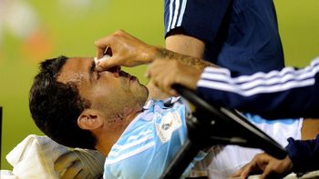 carlos tevez sufrio una fisura de tabique nasal pero podria jugar con boca carlos tevez sufrio una fisura de tabique nasal pero podria jugar con boca