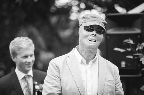 La foto del bombero sueco Lasse Gustavson que fue borrada dos veces por Facebook.