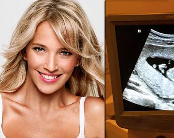La primera ecografía del segundo bebé de Luisana Lopilato