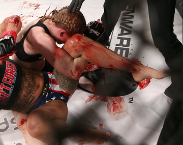 Hansen sufrió la brutalidad de su rival