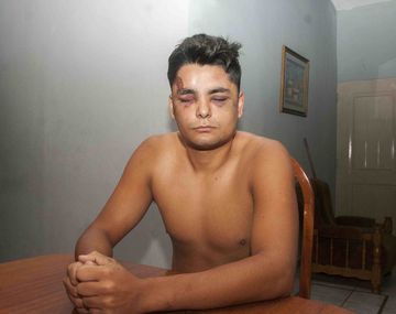 Claudio Torres Brizuela fue salvajemente golpeado por la policía