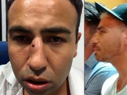 Fede Bal denunciado Fede Bal denunciado