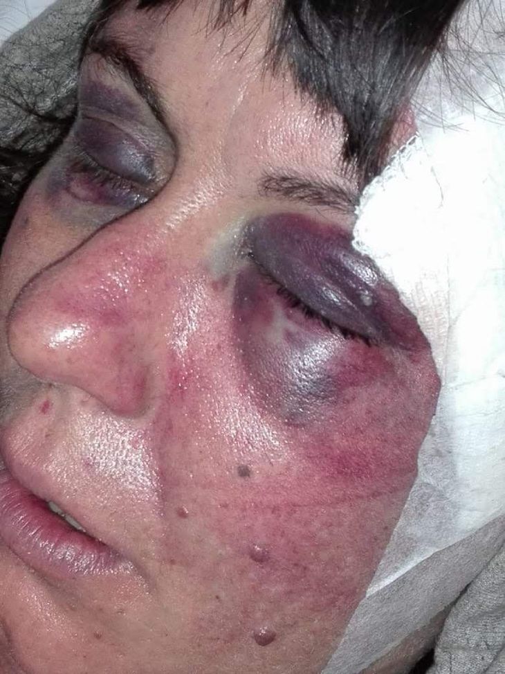 Comisario de San Clemente del Tuyú Roberto Romero acusado de golpear a un paciente psiquiátrica