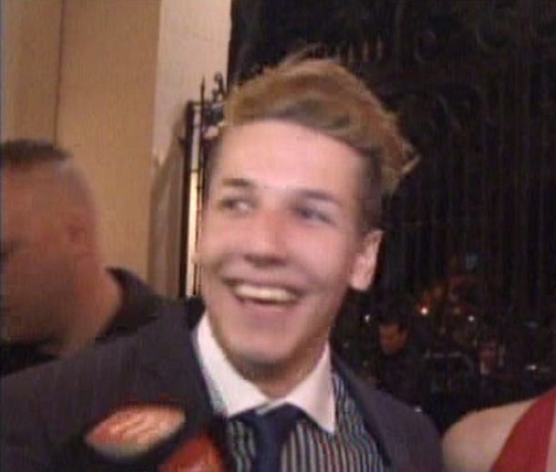 Alexander Caniggia también se hizo un retoque y tiene dientes nuevos