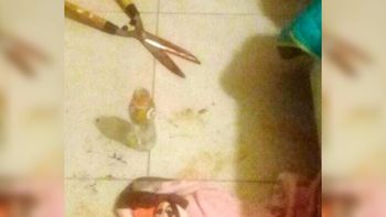 se recupera el hombre al que su amante le corto el pene se recupera el hombre al que su amante le corto el pene