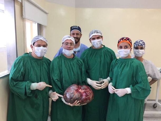 Un tumor de 15 kilos le fue extraído a una mujer en Catamarca.&nbsp;