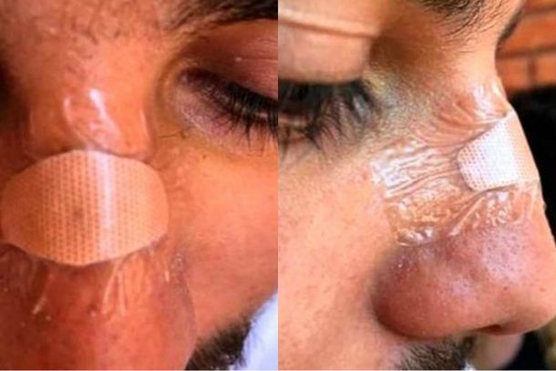 Quiso defender a su novia y rugbiers lo golpearon