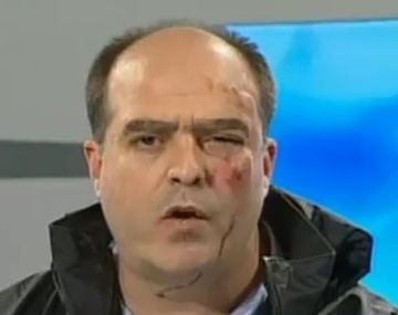 Golpean a diputados opositores en el congreso de Venezuela