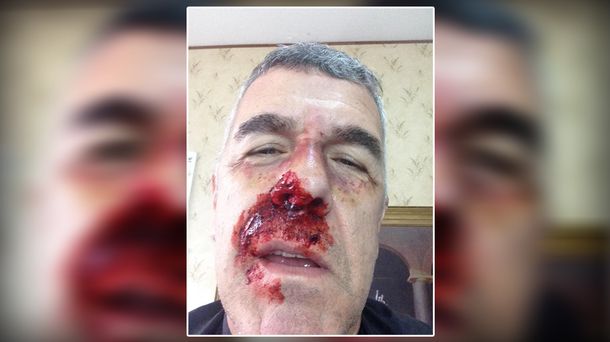 ¿Qué le pasó a Dady Brieva?