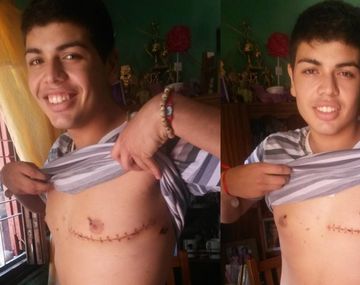 Joven de 16 años vive con una bala en su corazón